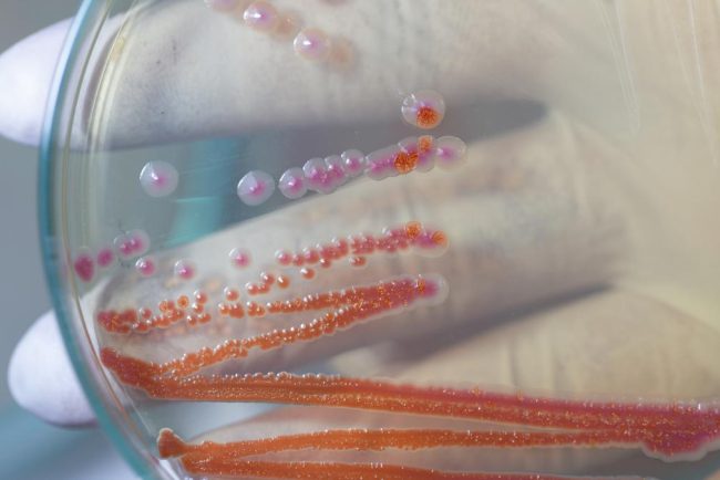 Serratia Marcescens bacteria care a ucis sase copii