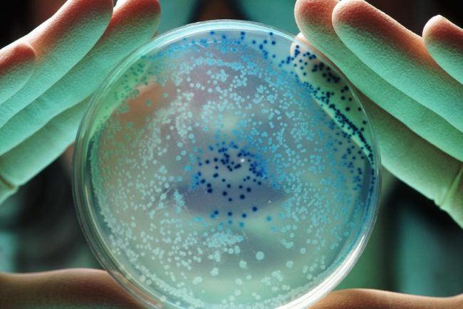 Ce este si cum se raspandeste bacteria din sursa spitalului