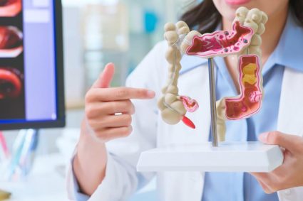De ce tot mai multi tineri dezvolta cancer colorectal In anumite tari aceasta a devenit principala cauza de deces