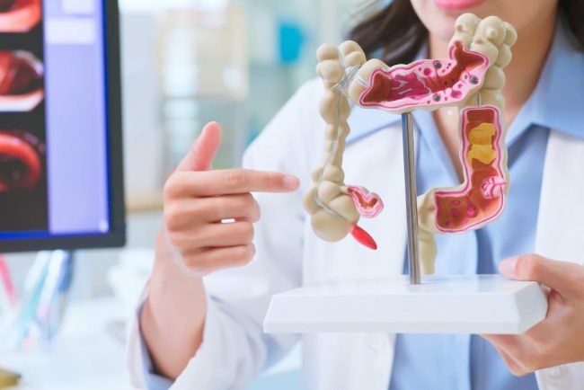 De ce tot mai multi tineri dezvolta cancer colorectal In anumite tari aceasta a devenit principala cauza de deces