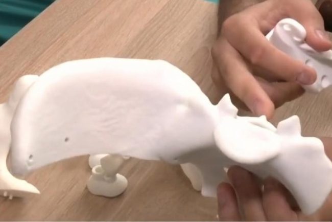Performanta medicala deosebita la Oradea Bazinul unei femei a fost reconstruit din componente de titan
